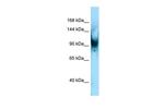 SENP6 Polyclonal Antibody