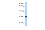 PLEKHF2 Antibody in Western Blot (WB)