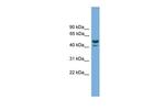 ANHX Polyclonal Antibody