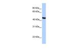 MSL3L2 Polyclonal Antibody