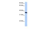 ZNF192P1 Polyclonal Antibody