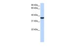 TP53I13 Polyclonal Antibody