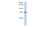 TNRC18B Antibody in Western Blot (WB)