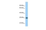 ASB11 Polyclonal Antibody