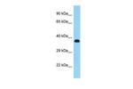 KERA Polyclonal Antibody