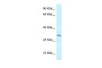 TAF8 Polyclonal Antibody
