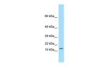 Otos Polyclonal Antibody
