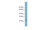 C5orf24 Polyclonal Antibody