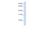 RDH12 Polyclonal Antibody