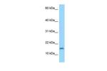 C3orf22 Polyclonal Antibody