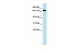 CCDC185 Polyclonal Antibody