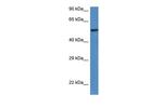 LACC1 Polyclonal Antibody