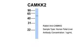 CaMKK beta Polyclonal Antibody