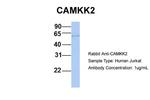 CaMKK beta Antibody in Western Blot (WB)