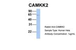 CaMKK beta Antibody in Western Blot (WB)