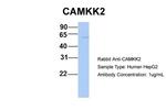 CaMKK beta Antibody in Western Blot (WB)