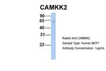 CaMKK beta Antibody in Western Blot (WB)