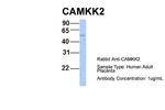 CaMKK beta Antibody in Western Blot (WB)