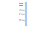 SAMD14 Polyclonal Antibody
