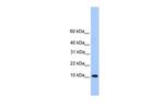 TRAPPC6B Polyclonal Antibody