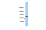FAM101A Polyclonal Antibody