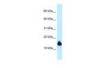 1110059E24Rik Polyclonal Antibody
