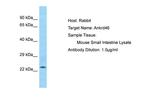 ANKRD46 Polyclonal Antibody