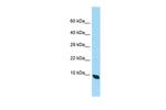 QIL1 Polyclonal Antibody