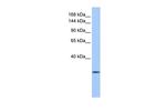 CLMN Polyclonal Antibody