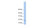 LOC284009 Antibody in Western Blot (WB)