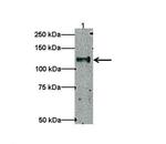 TRAK1 Polyclonal Antibody