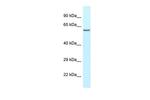 HABP2 Polyclonal Antibody