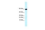 GDF10 Polyclonal Antibody