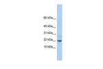 FAM219A Polyclonal Antibody