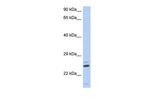 TTC9C Polyclonal Antibody