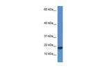 ISCU Polyclonal Antibody