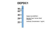 DEPDC1 Antibody in Western Blot (WB)