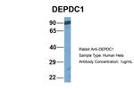 DEPDC1 Antibody in Western Blot (WB)