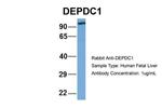 DEPDC1 Polyclonal Antibody
