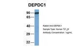 DEPDC1 Antibody in Western Blot (WB)
