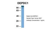 DEPDC1 Antibody in Western Blot (WB)