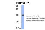 PRPSAP2 Polyclonal Antibody