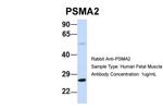 PSMA2 Polyclonal Antibody