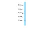 S100A5 Polyclonal Antibody