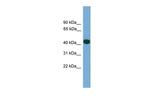 SERPINI2 Polyclonal Antibody