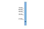 POP5 Polyclonal Antibody