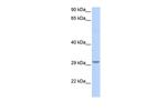 ABHD17B Antibody in Western Blot (WB)
