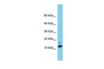 MED31 Polyclonal Antibody