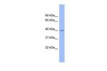 FAM45B Polyclonal Antibody