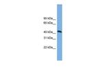 ANKMY2 Polyclonal Antibody